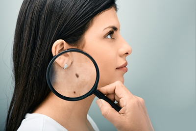 Woman closely inspecting skin mole with magnifying glass